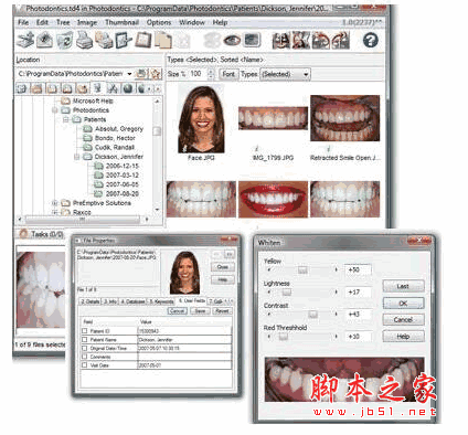 Photodontics Pro(牙科图像管理系统) v1.0 安装免费版