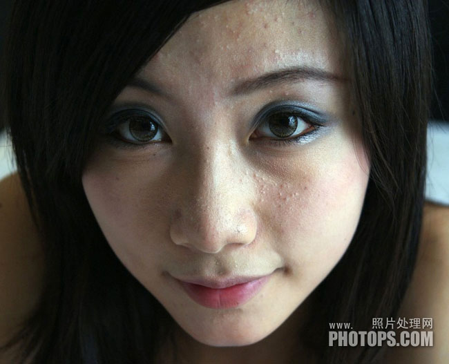 photoshop利用Neat Image外掛濾鏡快速給長(zhǎng)痘的人物臉部精細(xì)磨皮教程