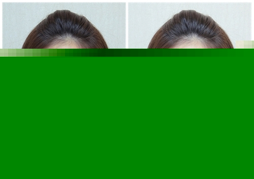 美图秀秀消除欧洲杯熬夜黑眼圈 每天神采奕奕 三联教程