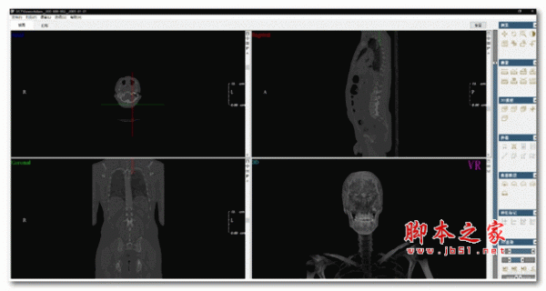 DCTViewer(CBCT查看器) v2.0.1 官方版