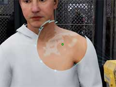 检疫区最后一站皮肤苍白怎么处理？皮肤苍白症状说明