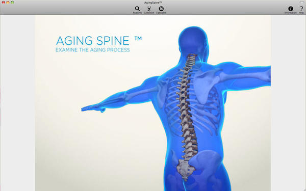 Aging Spine for mac V1.0 苹果电脑版