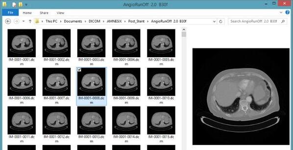 DICOM Thumbnailer下载 DICOM Thumbnailer(dicom缩略图查看软件) v1.7.0 官方安装版