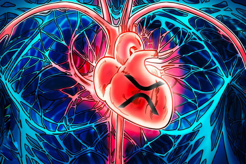 为什么瑞波币（XRP）很重要：推动其价值超越价格的5个关键因素
