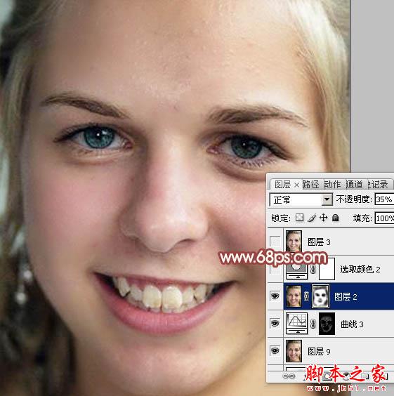 photoshop利用通道为满脸痘痘人物磨皮教程