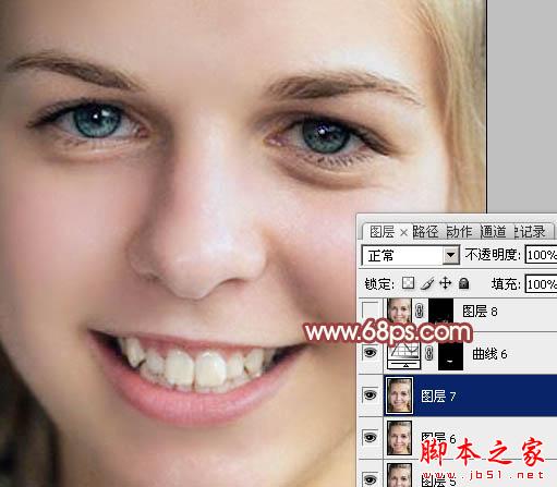 photoshop利用通道为满脸痘痘人物磨皮教程